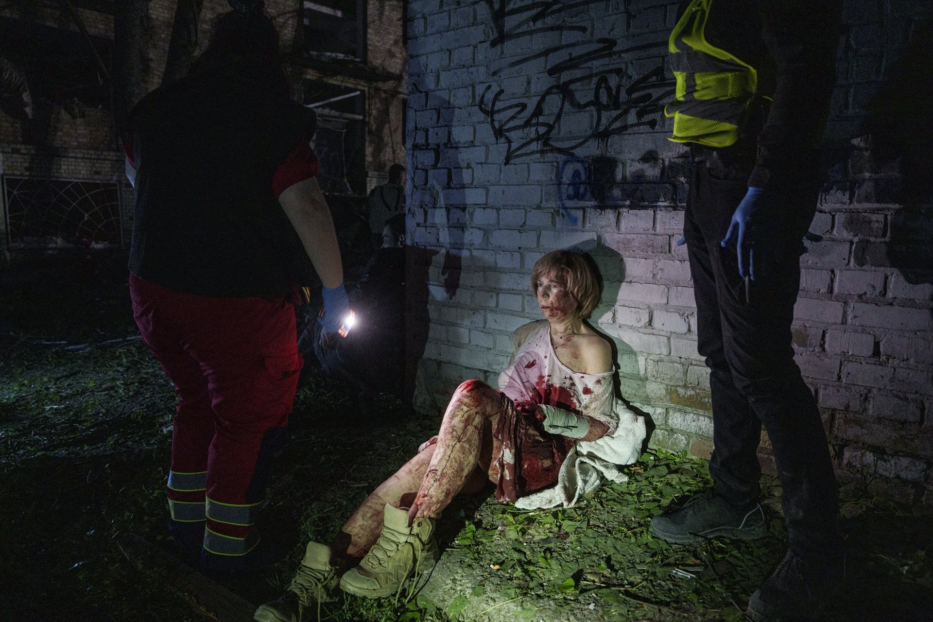 An injured woman sits near her badly damaged home. She was asleep when a Russian missile destroyed the building opposite hers. Kyiv, Ukraine.